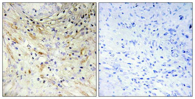 Anti-LAMB3 antibody produced in rabbit affinity isolated antibody