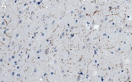 Anti-Neuropeptide Y Antibody, clone 2B5 ZooMAb® Rabbit Monoclonal recombinant, expressed in HEK 293 cells