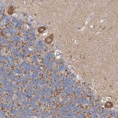 Anti-CPNE5 antibody produced in rabbit Prestige Antibodies® Powered by Atlas Antibodies, affinity isolated antibody, buffered aqueous glycerol solution
