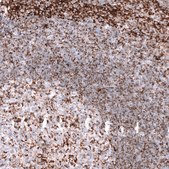 Anti-TSPO antibody produced in mouse Prestige Antibodies® Powered by Atlas Antibodies, clone CL13359, purified by using Protein A, buffered aqueous glycerol solution