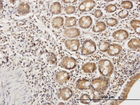 Anti-ETHE1 antibody produced in mouse IgG fraction of antiserum, buffered aqueous solution