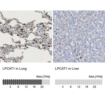 Anti-LPCAT1 antibody produced in rabbit Prestige Antibodies&#174; Powered by Atlas Antibodies, affinity isolated antibody, buffered aqueous glycerol solution, Ab2