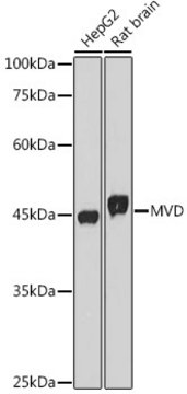 Anti-MVD Antibody, clone 7G4B9, Rabbit Monoclonal