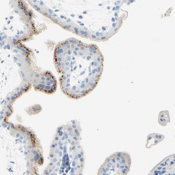 Anti-IL6ST antibody produced in rabbit Prestige Antibodies&#174; Powered by Atlas Antibodies, affinity isolated antibody, buffered aqueous glycerol solution