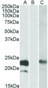 Anti-CST8 antibody produced in goat affinity isolated antibody, buffered aqueous solution