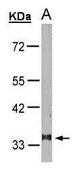 Anti-LTB4R antibody produced in rabbit affinity isolated antibody, buffered aqueous solution