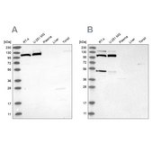Anti-MTHFD1L antibody produced in rabbit Prestige Antibodies® Powered by Atlas Antibodies, affinity isolated antibody, buffered aqueous glycerol solution
