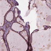 Anti-DNASE2 antibody produced in rabbit Prestige Antibodies® Powered by Atlas Antibodies, affinity isolated antibody, buffered aqueous glycerol solution