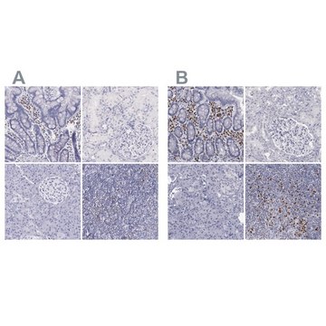 Anti-IRF4 antibody produced in rabbit Prestige Antibodies&#174; Powered by Atlas Antibodies, affinity isolated antibody, buffered aqueous glycerol solution