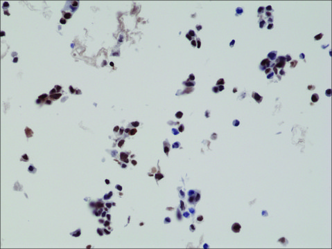 抗-HA-标记抗体，兔单克隆抗体 recombinant, expressed in HEK 293 cells, clone RM305, purified immunoglobulin