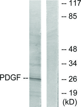 Anti-PDGFB antibody produced in rabbit affinity isolated antibody