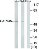 Anti-Parkin antibody produced in rabbit affinity isolated antibody