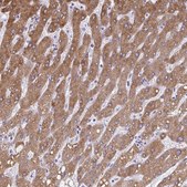 Anti-CYB5A antibody produced in rabbit Prestige Antibodies® Powered by Atlas Antibodies, affinity isolated antibody, buffered aqueous glycerol solution