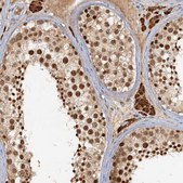 Anti-GPATCH11 antibody produced in rabbit Prestige Antibodies® Powered by Atlas Antibodies, affinity isolated antibody, buffered aqueous glycerol solution