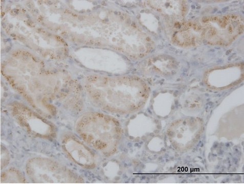 Anti-CTSH antibody produced in mouse purified immunoglobulin, buffered aqueous solution