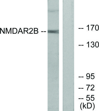 Anti-NMDAR2B antibody produced in rabbit affinity isolated antibody