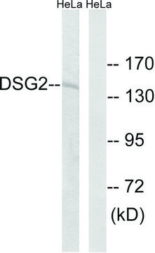 Anti-DSG2 antibody produced in rabbit affinity isolated antibody