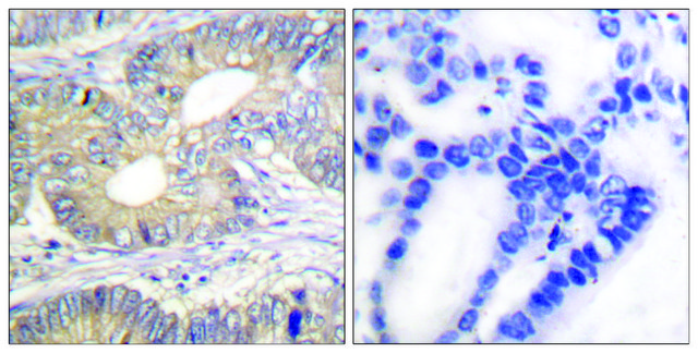 抗生长抑素 兔抗 affinity isolated antibody