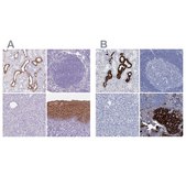 Anti-RHCG antibody produced in rabbit Prestige Antibodies® Powered by Atlas Antibodies, affinity isolated antibody, buffered aqueous glycerol solution