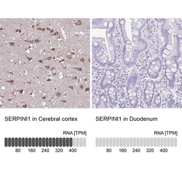 Anti-SERPINI1 antibody produced in rabbit Prestige Antibodies&#174; Powered by Atlas Antibodies, affinity isolated antibody, buffered aqueous glycerol solution