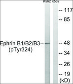 Anti-phospho-Ephrin B1/B2/B3 (pTyr324) antibody produced in rabbit affinity isolated antibody