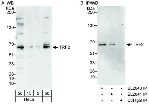 Rabbit anti-TRF2 Antibody, Affinity Purified Powered by Bethyl Laboratories, Inc.