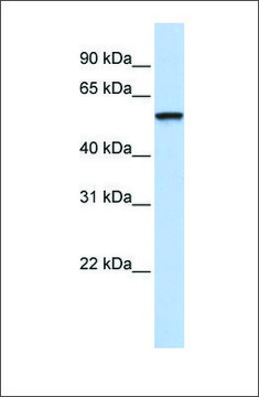 抗-TRIM4 兔抗 affinity isolated antibody