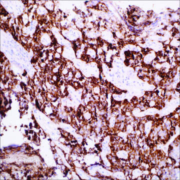 FSH (EP257) Rabbit Monoclonal Primary Antibody