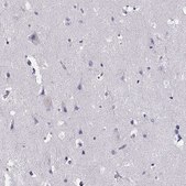 Anti-CCR8 antibody produced in rabbit Prestige Antibodies® Powered by Atlas Antibodies, affinity isolated antibody