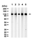 Anti-&#945;-Actinin-1 Antibody, clone 2C17 ZooMAb&#174; Rabbit Monoclonal recombinant, expressed in HEK 293 cells