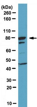 Anti-FoxP2 Antibody serum, from rabbit