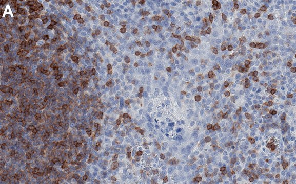 Anti-Lck Antibody, clone 2B20 ZooMAb&#174; Rabbit Monoclonal recombinant, expressed in HEK 293 cells