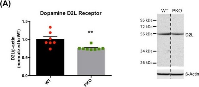 Anti-Dopamine D2 Receptor Antibody, cytoplasmic domain, long form Chemicon&#174;, from rabbit