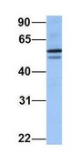 Anti-CUGBP2 antibody produced in rabbit affinity isolated antibody
