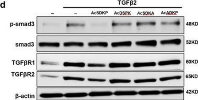 Anti-TGF &#946; Receptor I antibody produced in rabbit affinity isolated antibody