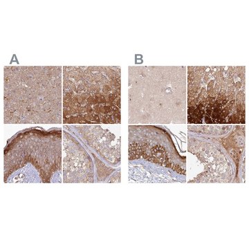 Anti-HAL antibody produced in rabbit Prestige Antibodies&#174; Powered by Atlas Antibodies, affinity isolated antibody, buffered aqueous glycerol solution