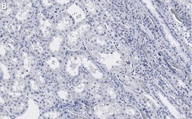 Anti-PP2A C subunit Antibody, clone 2B15 ZooMAb® Rabbit Monoclonal recombinant, expressed in HEK 293 cells