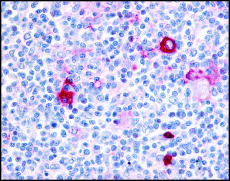 Anti-ITGA4 (AB1) antibody produced in rabbit affinity isolated antibody, buffered aqueous solution