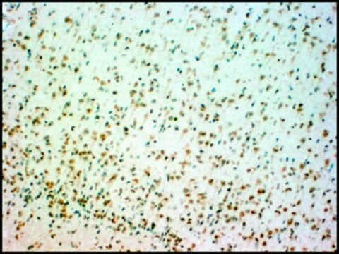 Anti-TPH2 antibody produced in goat affinity isolated antibody, buffered aqueous solution