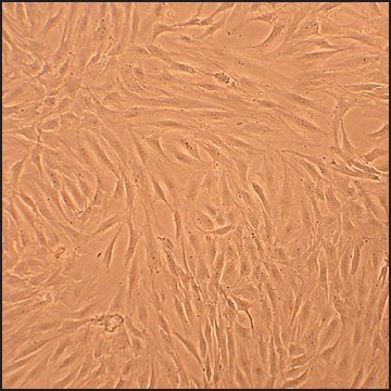 Human Osteoblasts-Osteoarthritis: HOb-OA, adult