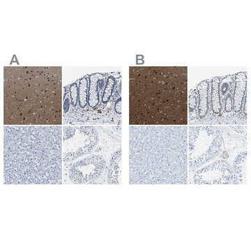 Anti-MAPRE2 antibody produced in rabbit Prestige Antibodies&#174; Powered by Atlas Antibodies, affinity isolated antibody, buffered aqueous glycerol solution