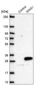Anti-GINS1 antibody produced in rabbit Prestige Antibodies® Powered by Atlas Antibodies, affinity isolated antibody, buffered aqueous glycerol solution