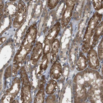 Anti-RNF130 antibody produced in rabbit Prestige Antibodies&#174; Powered by Atlas Antibodies, affinity isolated antibody, buffered aqueous glycerol solution