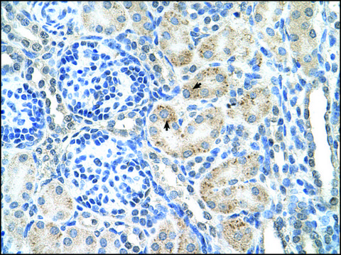 Anti-SPPL2B antibody produced in rabbit affinity isolated antibody