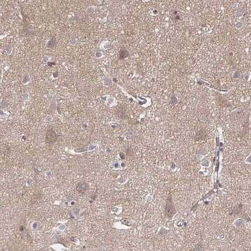 Anti-APBB1 antibody produced in rabbit Prestige Antibodies&#174; Powered by Atlas Antibodies, affinity isolated antibody, buffered aqueous glycerol solution