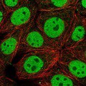 Anti-HYPK antibody produced in rabbit Prestige Antibodies® Powered by Atlas Antibodies, affinity isolated antibody, buffered aqueous glycerol solution