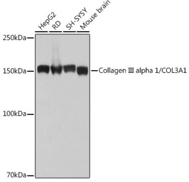 Anti-Collagen III alpha 1/COL3A1 Antibody, clone 6Y9C6, Rabbit Monoclonal