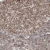 Anti-ARGLU1 antibody produced in rabbit Prestige Antibodies® Powered by Atlas Antibodies, affinity isolated antibody, buffered aqueous glycerol solution