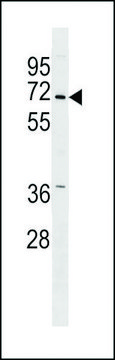 ANTI-PINK1 (PARK6) (CENTER) antibody produced in rabbit purified immunoglobulin, buffered aqueous solution