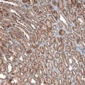 Anti-ZCCHC7 antibody produced in rabbit Prestige Antibodies® Powered by Atlas Antibodies, affinity isolated antibody, buffered aqueous glycerol solution